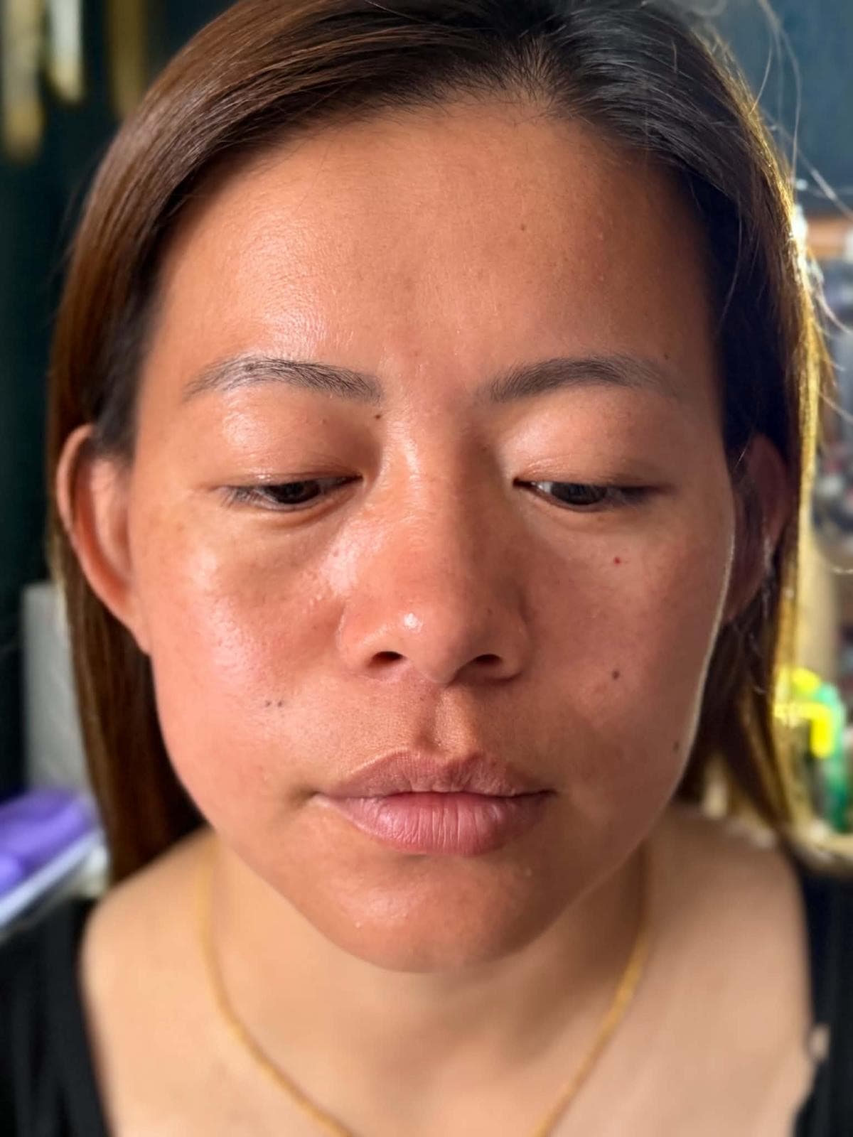 Post-treatment glow — Skin